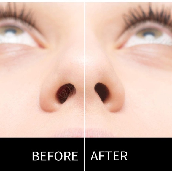 ✨BlueZOO✨Hair Removal Waxing Kit - Picture 6 of 7